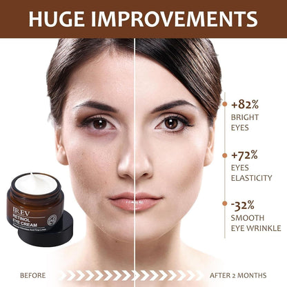 IREV- Retinol Eye Cream